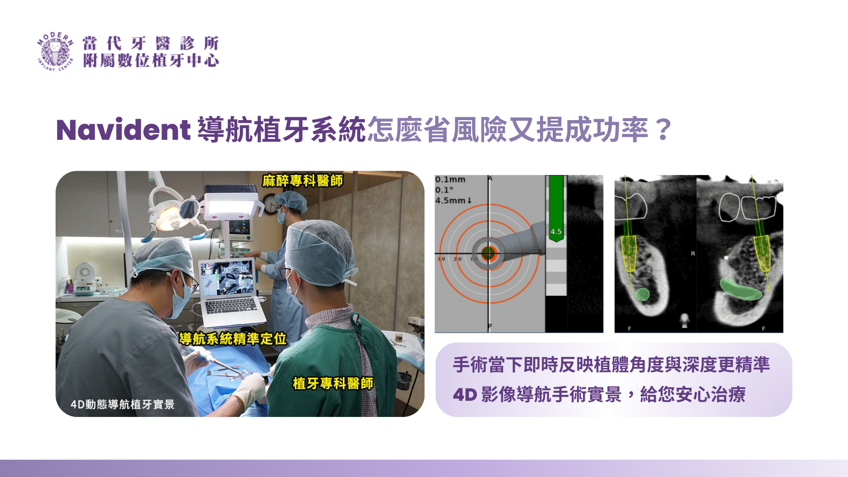 導航植牙怎麼省風險又提成功率？ 當代牙醫診所全口重建暨數位植牙中心導入 Navident 系統