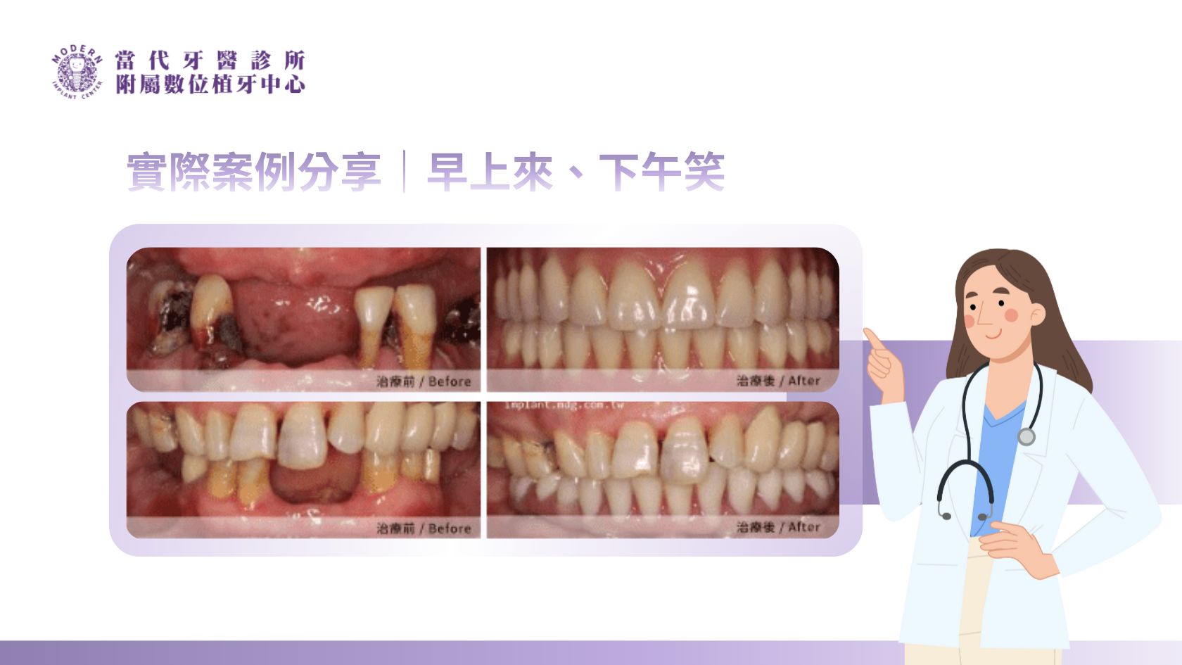一日全口重建完整流程：早上來、下午笑｜全口重建推薦當代牙醫