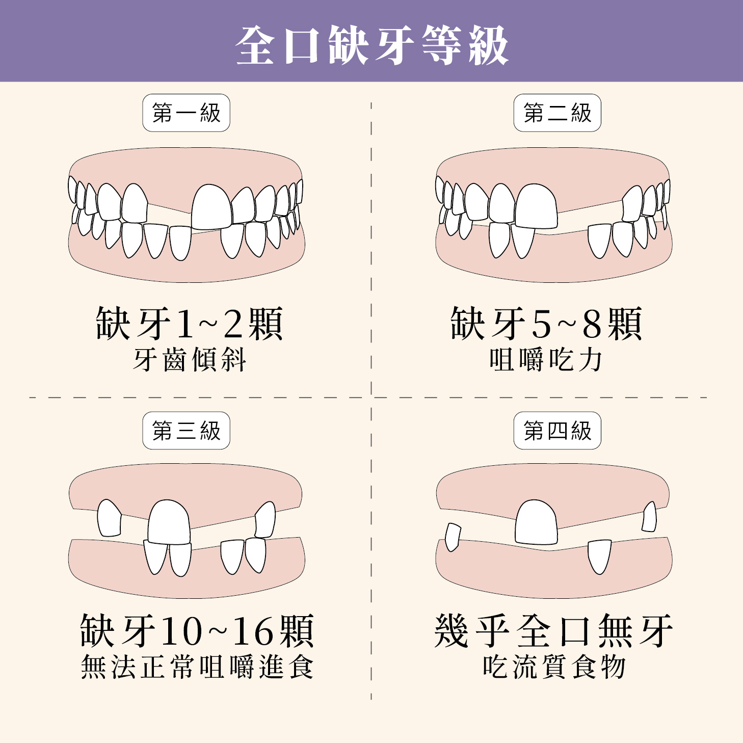 第一次植牙評估與口腔影像檢查